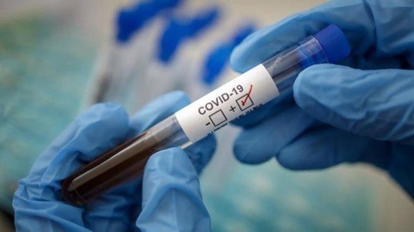 Зарегистрировано 5 случаев смерти от коронавирусной инфекции в Татарстане