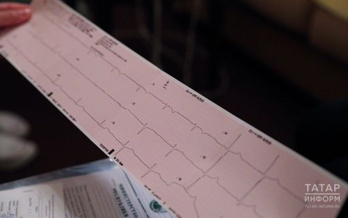 Пять советов, чтобы сберечь свое сердце и сосуды